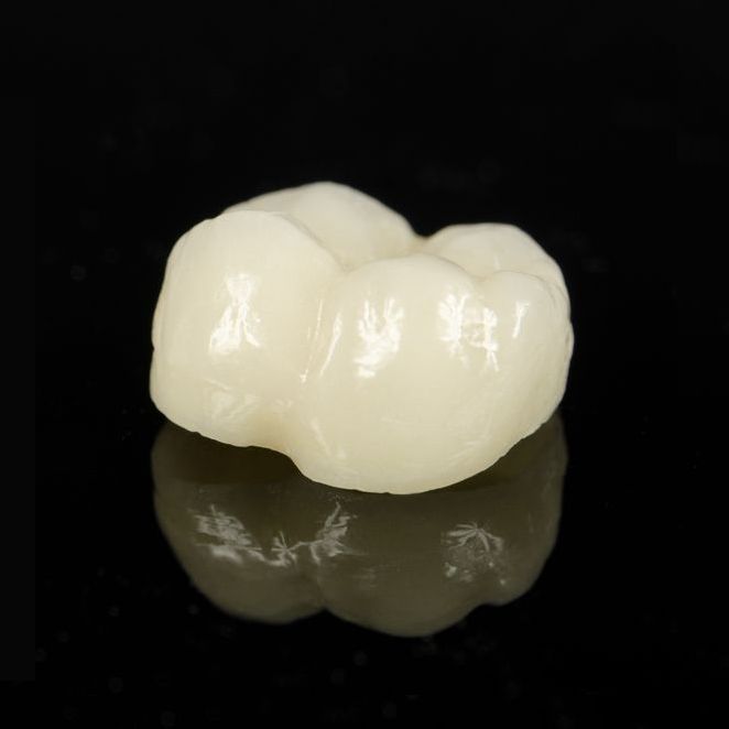 Close-up of dental crown before restorative dentistry procedure